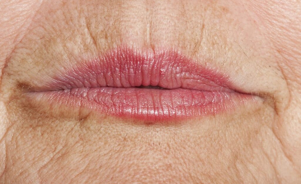 Arrugas en los Labios - Código de Barras